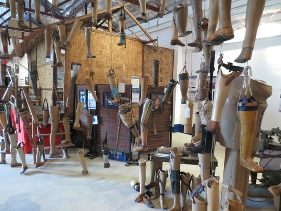 Laos Cooperative Orthotic and Prosthetic Enterprise
